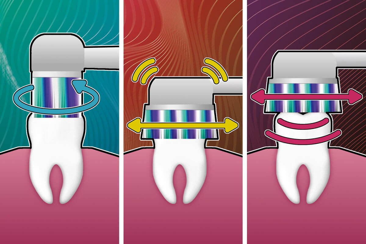 Die Bewebungsmuster von Rotations-, Schall-, und Ultraschallbuersten