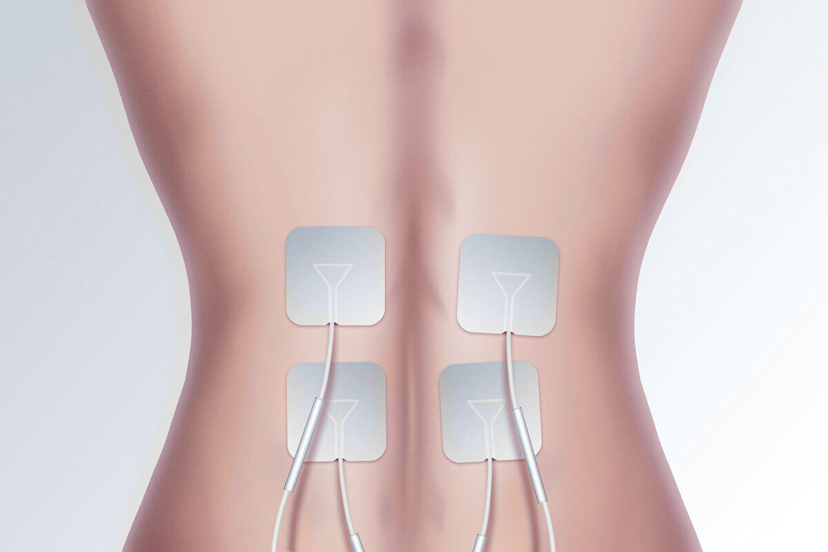 Elektroden-Pads am Ruecken